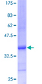 UBL5 Protein - 12.5% SDS-PAGE of human UBL5 stained with Coomassie Blue