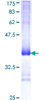 UBL5 Protein - 12.5% SDS-PAGE Stained with Coomassie Blue.