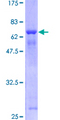 UBLCP1 Protein - 12.5% SDS-PAGE of human UBLCP1 stained with Coomassie Blue
