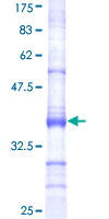 UBP43 / USP18 Protein - 12.5% SDS-PAGE Stained with Coomassie Blue.