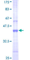 UBR1 Protein - 12.5% SDS-PAGE Stained with Coomassie Blue.