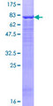 UBR2 Protein - 12.5% SDS-PAGE of human UBR2 stained with Coomassie Blue