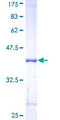 UBR2 Protein - 12.5% SDS-PAGE Stained with Coomassie Blue.