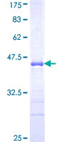 UBR3 Protein - 12.5% SDS-PAGE Stained with Coomassie Blue.