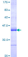 UBR4 Protein - 12.5% SDS-PAGE Stained with Coomassie Blue