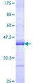 UBR4 Protein - 12.5% SDS-PAGE Stained with Coomassie Blue