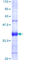 UBR5 Protein - 12.5% SDS-PAGE Stained with Coomassie Blue.