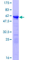 UBR7 / C14orf130 Protein - 12.5% SDS-PAGE of human C14orf130 stained with Coomassie Blue
