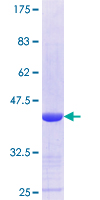 UBR7 / C14orf130 Protein - 12.5% SDS-PAGE Stained with Coomassie Blue.