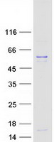 UBR7 / C14orf130 Protein - Purified recombinant protein UBR7 was analyzed by SDS-PAGE gel and Coomassie Blue Staining