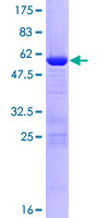 UBTD1 Protein - 12.5% SDS-PAGE of human UBTD1 stained with Coomassie Blue