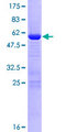 UBTD1 Protein - 12.5% SDS-PAGE of human UBTD1 stained with Coomassie Blue