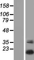 UBTD2 Protein - Western validation with an anti-DDK antibody * L: Control HEK293 lysate R: Over-expression lysate