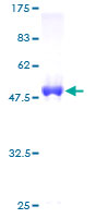 UBTD2 Protein - 12.5% SDS-PAGE of human DC-UbP stained with Coomassie Blue