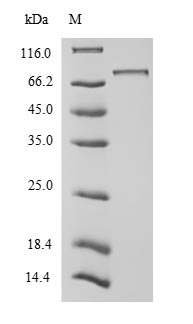 UBTF / UBF Protein - (Tris-Glycine gel) Discontinuous SDS-PAGE (reduced) with 5% enrichment gel and 15% separation gel.