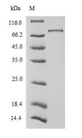 UBTF / UBF Protein - (Tris-Glycine gel) Discontinuous SDS-PAGE (reduced) with 5% enrichment gel and 15% separation gel.