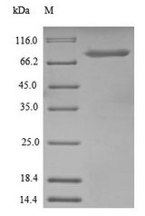 UBTF / UBF Protein - (Tris-Glycine gel) Discontinuous SDS-PAGE (reduced) with 5% enrichment gel and 15% separation gel.