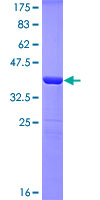 UBTF / UBF Protein - 12.5% SDS-PAGE Stained with Coomassie Blue.