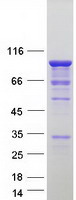 UBTF / UBF Protein - Purified recombinant protein UBTF was analyzed by SDS-PAGE gel and Coomassie Blue Staining