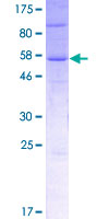 UBXD4 / UBXN2A Protein - 12.5% SDS-PAGE of human UBXD4 stained with Coomassie Blue