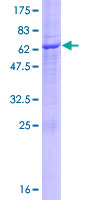 UBXD6 Protein - 12.5% SDS-PAGE of human UBXD6 stained with Coomassie Blue