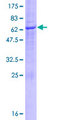 UBXD6 Protein - 12.5% SDS-PAGE of human UBXD6 stained with Coomassie Blue