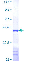 UBXD6 Protein - 12.5% SDS-PAGE Stained with Coomassie Blue.