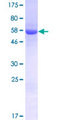 UBXD7 Protein - 12.5% SDS-PAGE of human UBXD7 stained with Coomassie Blue