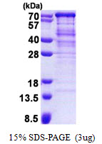 UBXD9 / ASPL Protein