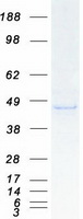 UBXN1 Protein - Purified recombinant protein UBXN1 was analyzed by SDS-PAGE gel and Coomassie Blue Staining