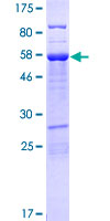 UBXN10 Protein - 12.5% SDS-PAGE of human UBXD3 stained with Coomassie Blue