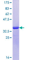 UBXN11 / SOC Protein - 12.5% SDS-PAGE Stained with Coomassie Blue.
