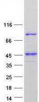 UBXN11 / SOC Protein - Purified recombinant protein UBXN11 was analyzed by SDS-PAGE gel and Coomassie Blue Staining