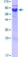 UBXN6 / UBXD1 Protein - 12.5% SDS-PAGE of human UBXN6 stained with Coomassie Blue