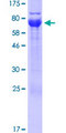 UBXN6 / UBXD1 Protein - 12.5% SDS-PAGE of human UBXN6 stained with Coomassie Blue