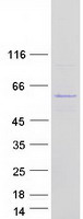 UBXN6 / UBXD1 Protein - Purified recombinant protein UBXN6 was analyzed by SDS-PAGE gel and Coomassie Blue Staining
