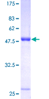 UCHL1 / PGP9.5 Protein - 12.5% SDS-PAGE of human UCHL1 stained with Coomassie Blue