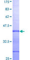UCHL1 / PGP9.5 Protein - 12.5% SDS-PAGE Stained with Coomassie Blue.