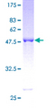 UCHL3 Protein - 12.5% SDS-PAGE of human UCHL3 stained with Coomassie Blue