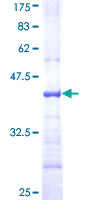 UCHL3 Protein - 12.5% SDS-PAGE Stained with Coomassie Blue.