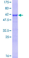 UCHL5 / UCH37 Protein - 12.5% SDS-PAGE of human UCHL5 stained with Coomassie Blue