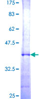 UCHL5 / UCH37 Protein - 12.5% SDS-PAGE Stained with Coomassie Blue.