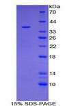 UCHL5 / UCH37 Protein - Recombinant Ubiquitin Carboxyl Terminal Hydrolase L5 By SDS-PAGE
