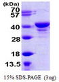 UCHL5 / UCH37 Protein