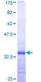 UCK1 Protein - 12.5% SDS-PAGE Stained with Coomassie Blue.