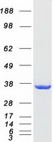 UCK1 Protein - Purified recombinant protein UCK1 was analyzed by SDS-PAGE gel and Coomassie Blue Staining