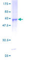 UCK2 Protein - 12.5% SDS-PAGE of human UCK2 stained with Coomassie Blue