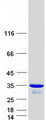 UCK2 Protein - Purified recombinant protein UCK2 was analyzed by SDS-PAGE gel and Coomassie Blue Staining