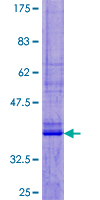 UCN2 / SRP Protein - 12.5% SDS-PAGE of human UCN2 stained with Coomassie Blue