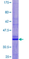 UCN2 / SRP Protein - 12.5% SDS-PAGE of human UCN2 stained with Coomassie Blue